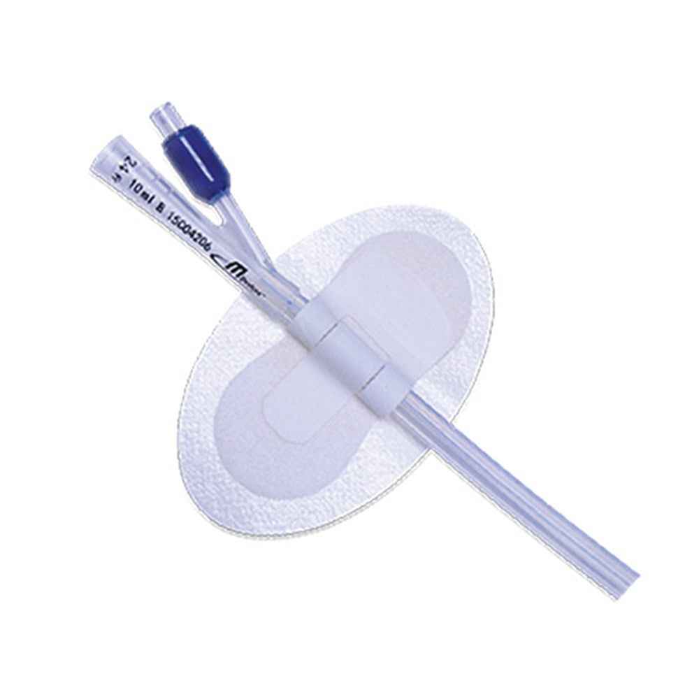 Catheter Securement Device