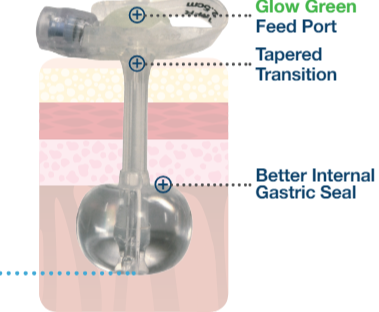 MiniONE Balloon Button