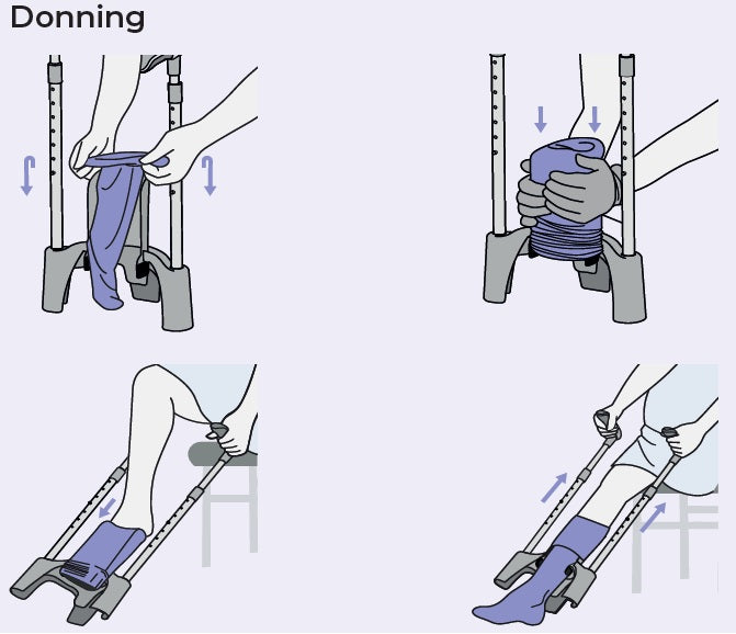 SIGVARIS Melany Donning Device
