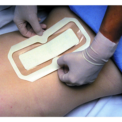 Tegaderm +Pad Island Dressing with Non-Adherent Pad